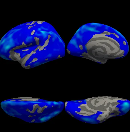 Four views of the left hemisphere, blue over most of the cortex.
